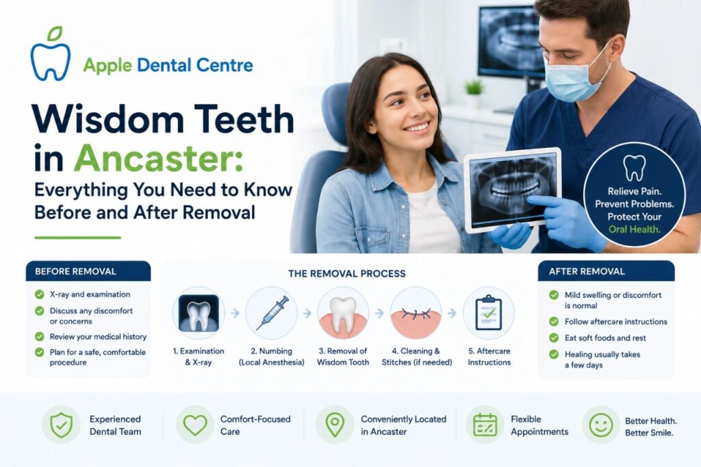 Wisdom Teeth
